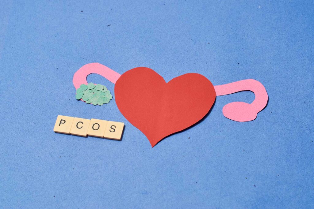 PCOS verstehen