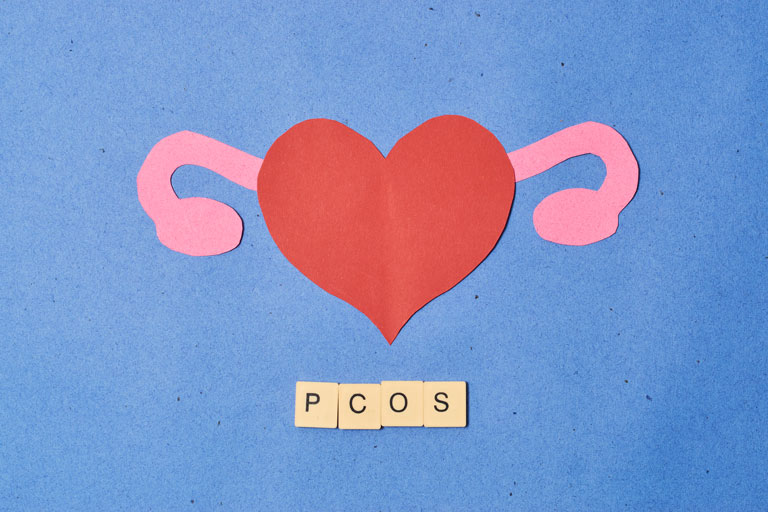 Fokus: PCOS